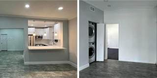 3681 NE 170th St Gallery 19