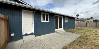 402 166th Street South Gallery 17