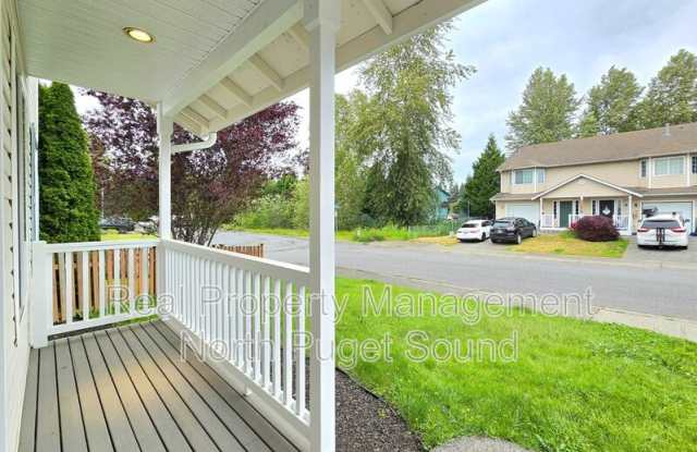 3104 186th Pl NE Gallery 2