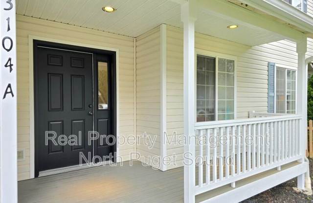 3104 186th Pl NE Gallery 1