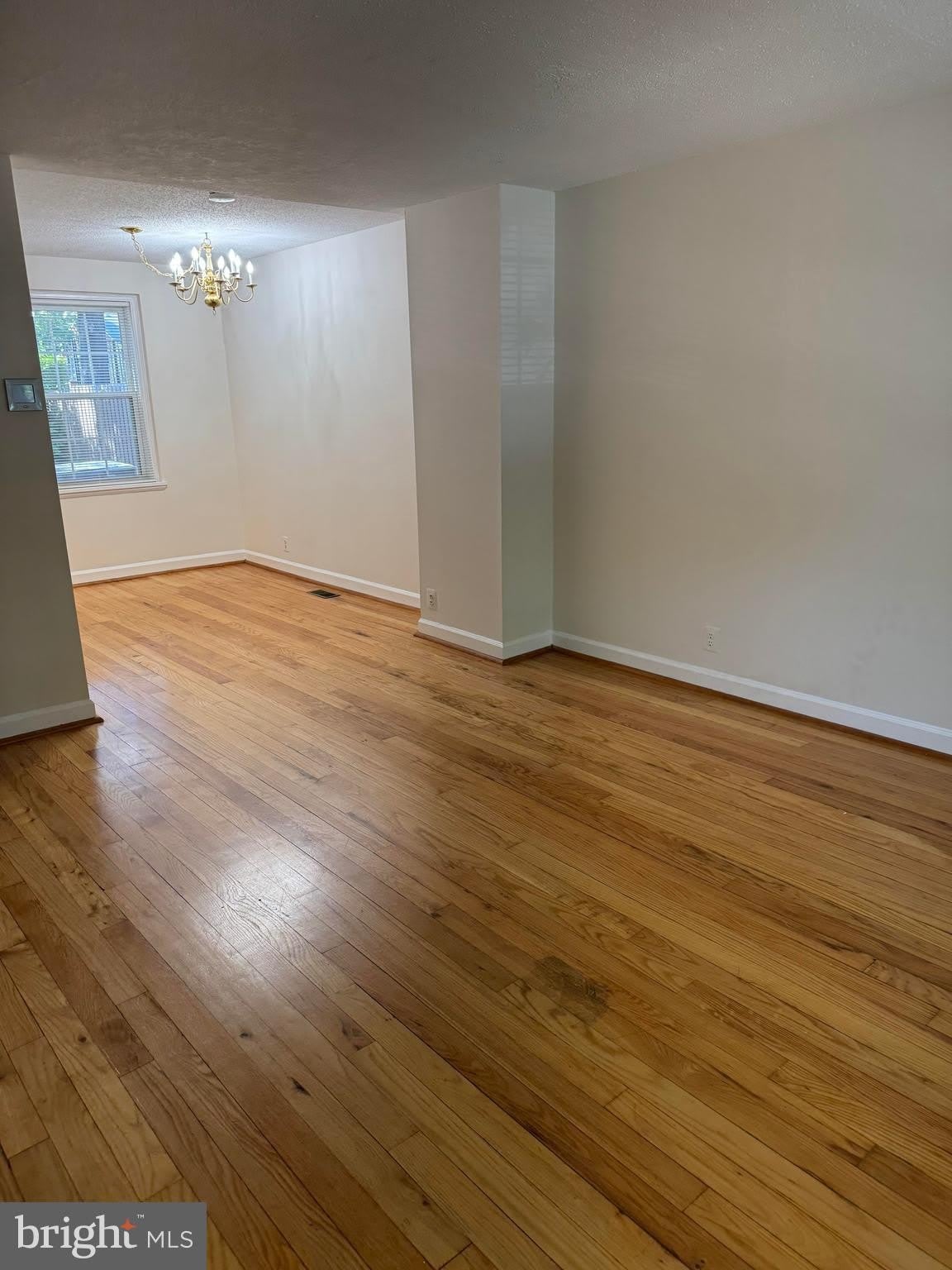 4715 29TH Street S – photo 5