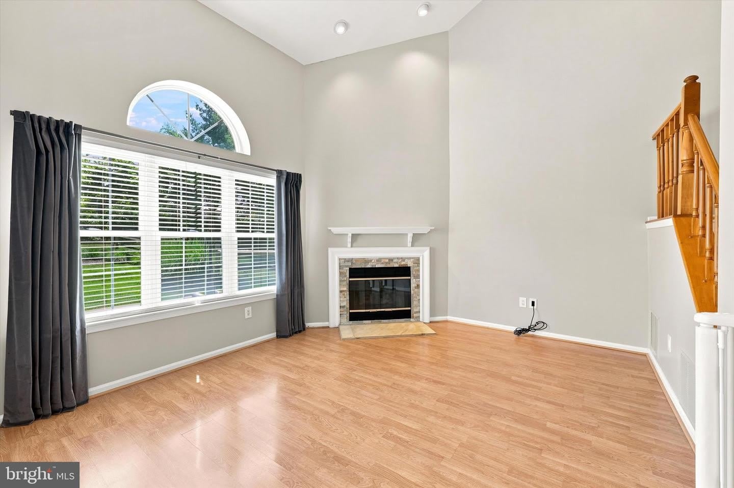 57 PARKVIEW – photo 4