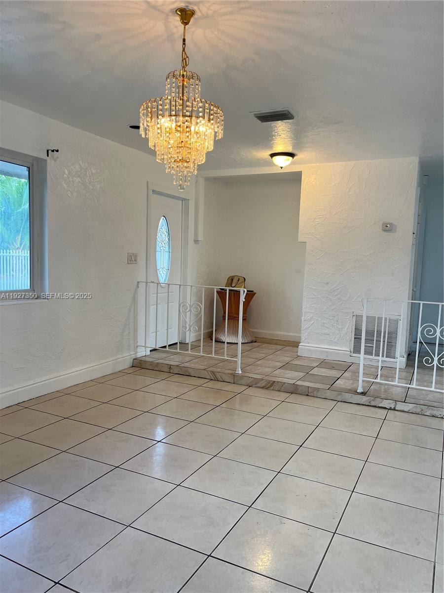 150 NE 173rd St – photo 3