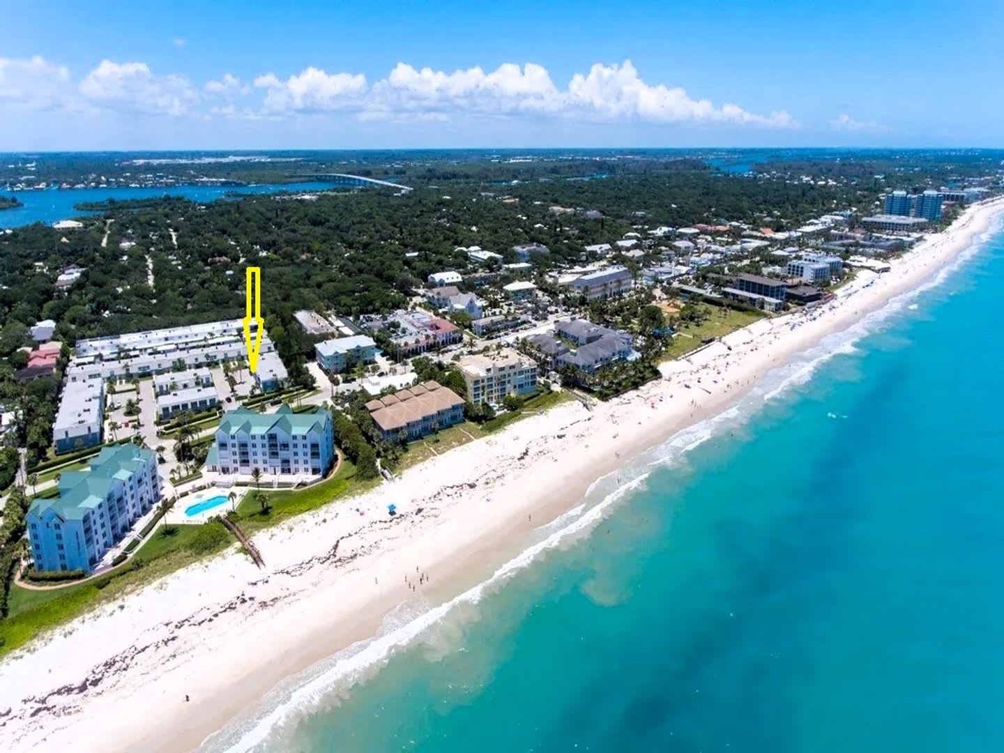 Ocean Towers Direct Beach Access – photo 1